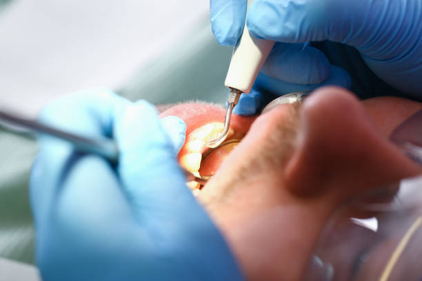 Best Walk-In Emergency Dentist in Wyoming, PA